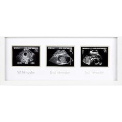 Pearhead 87038 Trimester Sonogram Frame Deluxe, trīs skenēšanas fotoattēlu rāmim, balts