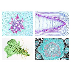 Bioloģijas mikroskopijas Micropräparates sērija — svira un aknu sūnas (Bryophyta, Marchantiophyta)