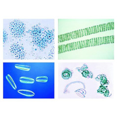 Bioloģijas mikroskopija Micropräparate Series_ Vide I: Mežs: meža postījumu cēloņi un sekas