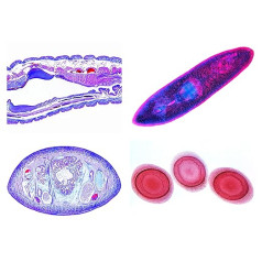 Bioloģijas mikroskopijas mikroskopijas sērija sūkļi un dobie dzīvnieki (Coelenterata, Porifera)