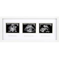 Pearhead 87038 Trimester Sonogram Frame Deluxe, foto rāmis trim ultraskaņas attēliem, balts