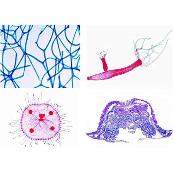 Bioloģijas mikroskopijas mikropreparātu sērija: Sērija: sūkļi un dobie dzīvnieki (Coelenterata, Porifera), Advanced Series, 10 preparāti, 10 preparāti.