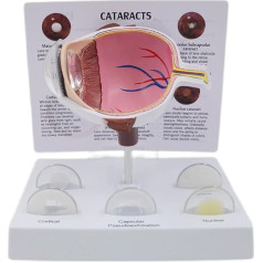 HBgjkrG Orgelmodell Menschliches Organmodell Pathologische Hornhaut Katarakt Augapfelanatomiemodell Demonstrationsunterricht Anatomiemodell