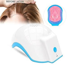 Cimenn Anti-Hair Loss Helmet, Hair Loss Regrowth Therapy Hair Growth Helmet Treatment Hair Cap Helmet Stimulates the Growth of Hair Follicles (02)