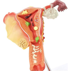 Orgelmodell Anatomisches menschliches Uterusmodell, Anatomiemodell aus PVC-Material mit abnehmbaren Organen, zum Lehren und Lernen, Anzeigewerkzeug Anatomiemodell