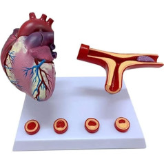 NIVJS Orgelmodell Arterien- und Blutgefäßblockade Thrombosemodell Menschliches Herzmodell Unterrichtsmodelle Wissenschaftsmodelle für Klassenzimmer und Kardiologiestudium Anatomiemodell