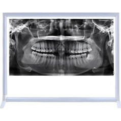 1 x laboratorijas aprīkojums X-Ray filmu gaismeklis Gaismas kaste X-ray Viewer Gaismas panelis Ekrāns