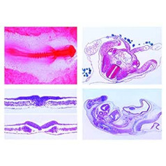 Mikropreparātu sērija — vistas embrija (Gallus) embrija attīstība