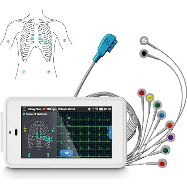 Wellue PG12 Professional 6 12 kanālu EKG ierīce, digitālā EKG ierīce ar Glāzgovas algoritmiem, atbalsta reāllaika EKG datu iegūšanu un analīzi, WiFi datu pārsūtīšanu un atskaišu drukāšanu mājas apstākļos